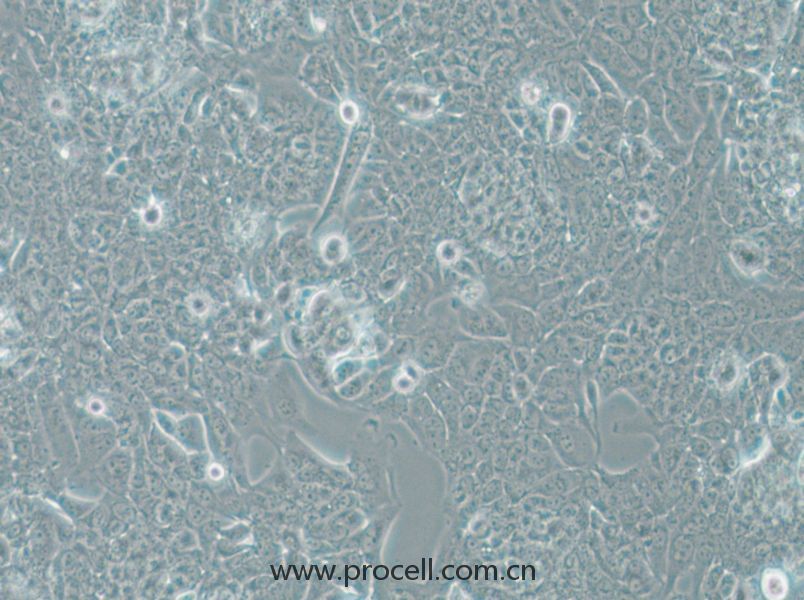 NCI-H1793 (人肺癌細(xì)胞) (STR鑒定正確)