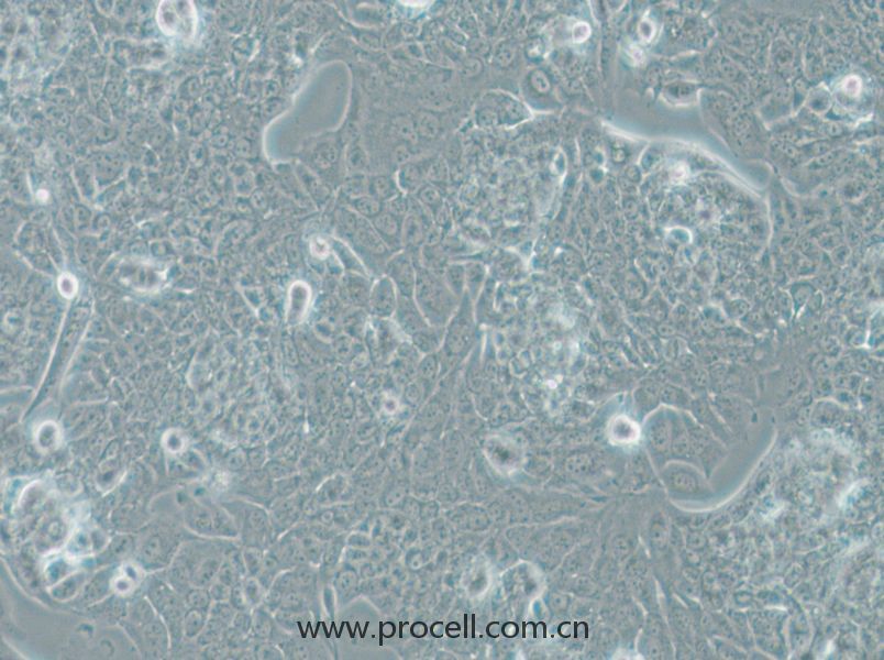 NCI-H1793 (人肺癌細(xì)胞) (STR鑒定正確)