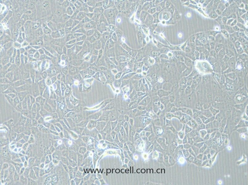 HCC-78 (人肺腺癌細胞) (STR鑒定正確)