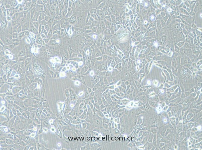 HCC-78 (人肺腺癌細胞) (STR鑒定正確)