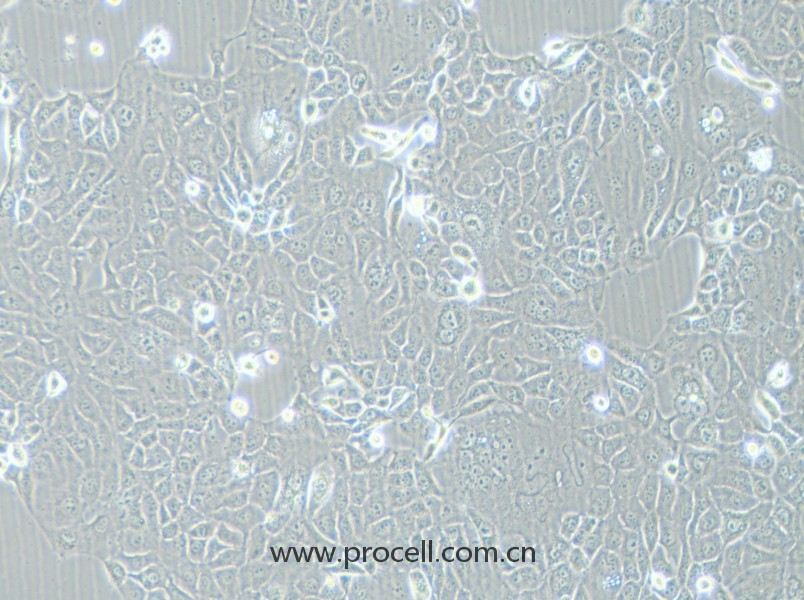 HCC-78 (人肺腺癌細胞) (STR鑒定正確)