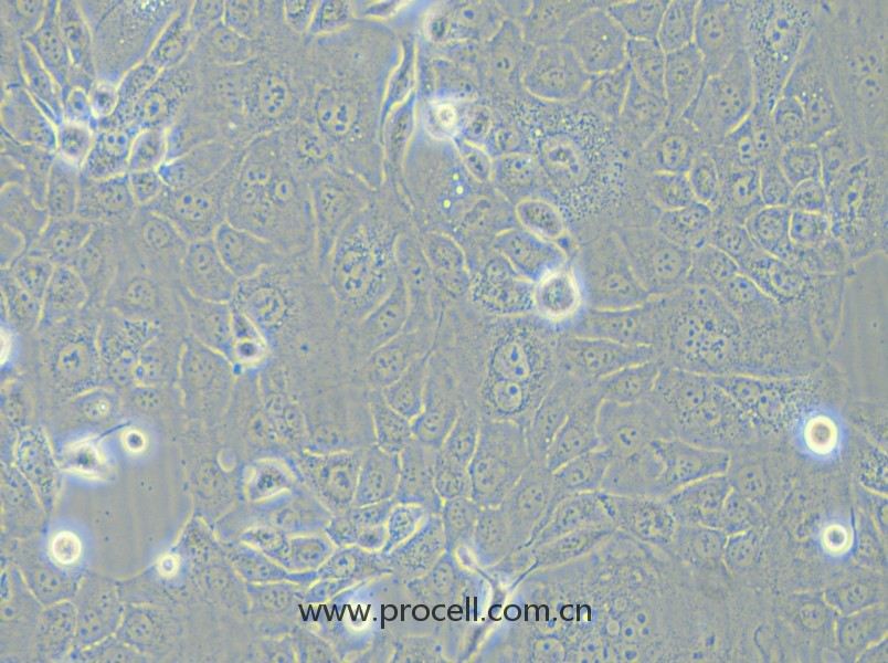 HCC-78 (人肺腺癌細胞) (STR鑒定正確)