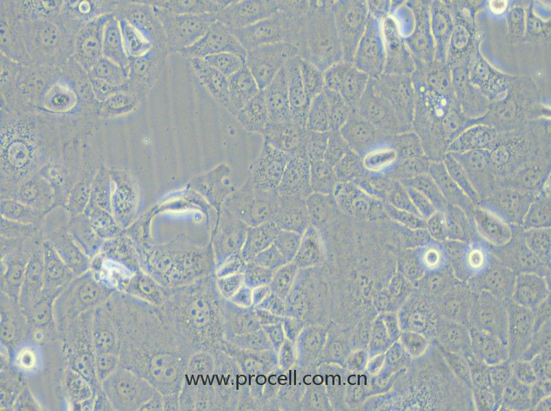 HCC-78 (人肺腺癌細胞) (STR鑒定正確)