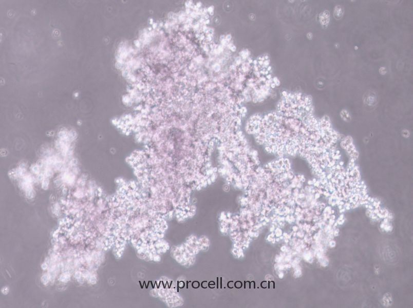 NCI-H660 (人神經(jīng)內(nèi)分泌前列腺癌細胞) (STR鑒定正確)