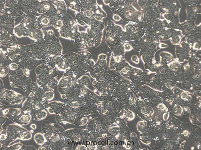 MFE-280 (人子宮內(nèi)膜腺癌細胞) (STR鑒定正確)