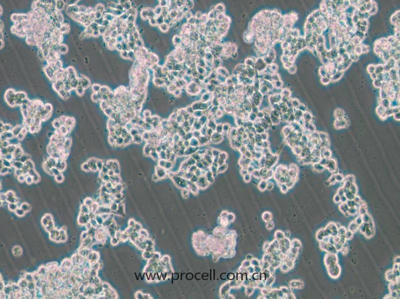 HCC1187（人乳腺導管癌細胞）（STR鑒定正確）
