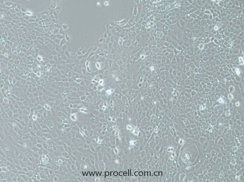 UM-SCC-1 (人口底鱗癌細胞) (STR鑒定正確)