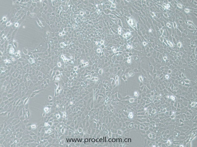 UM-SCC-1 (人口底鱗癌細胞) (STR鑒定正確)