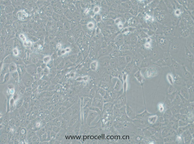 UM-SCC-1 (人口底鱗癌細胞) (STR鑒定正確)