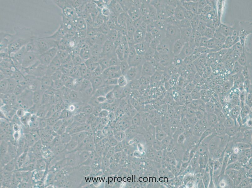 UM-SCC-1 (人口底鱗癌細胞) (STR鑒定正確)