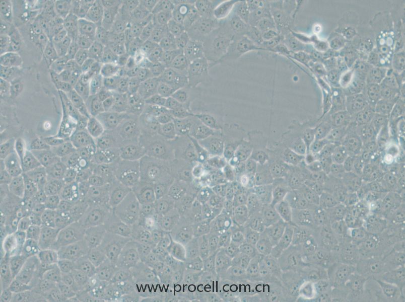 UM-SCC-1 (人口底鱗癌細胞) (STR鑒定正確)