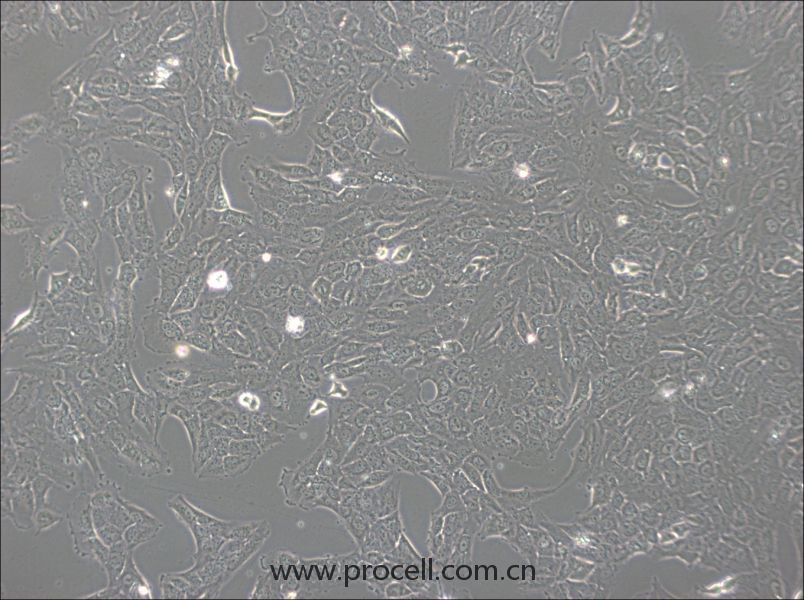 NCI-H1792(人肺腺癌細(xì)胞) (STR鑒定正確)