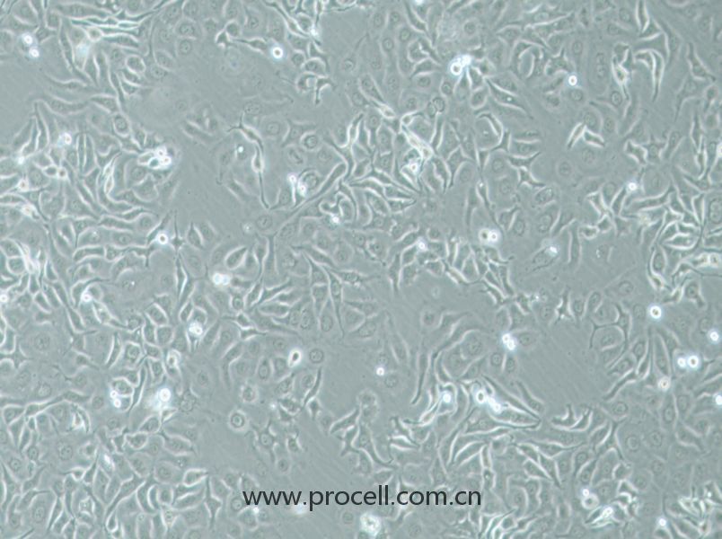 HCC1143 (人乳腺癌細胞) (STR鑒定正確)