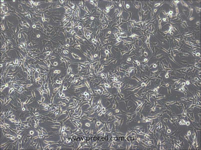 U-87 MG-LUC (人腦星形膠質(zhì)母細(xì)胞瘤細(xì)胞 (熒光素酶標(biāo)記)) (STR鑒定正確)