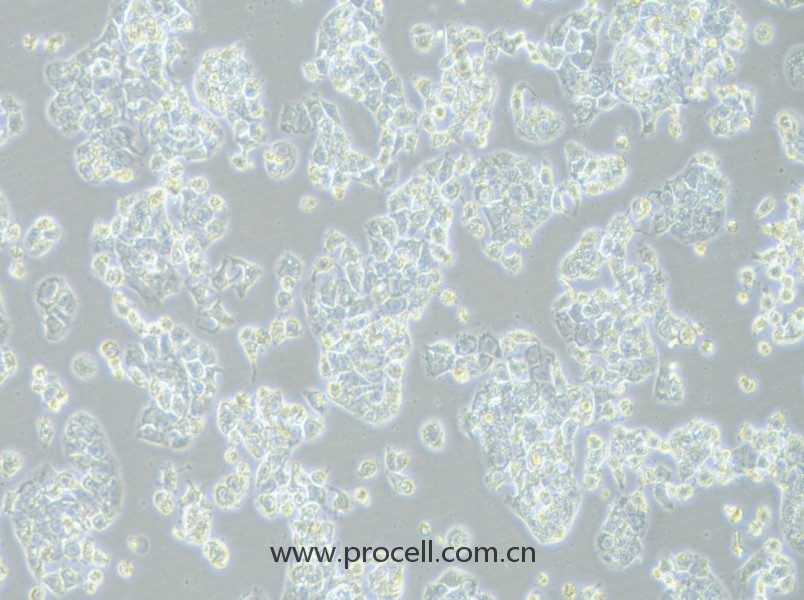 HCC1569（人乳腺癌細胞）（STR鑒定正確）