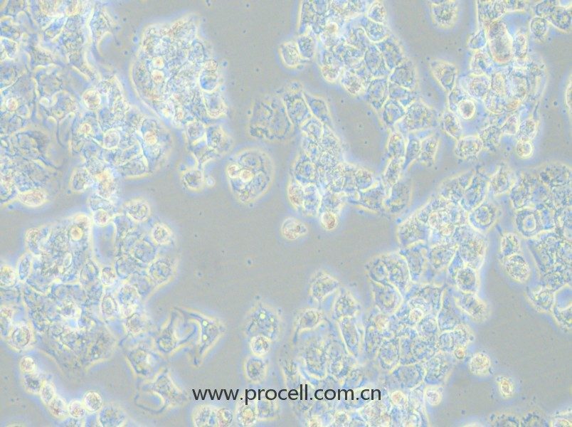 HCC1569（人乳腺癌細胞）（STR鑒定正確）