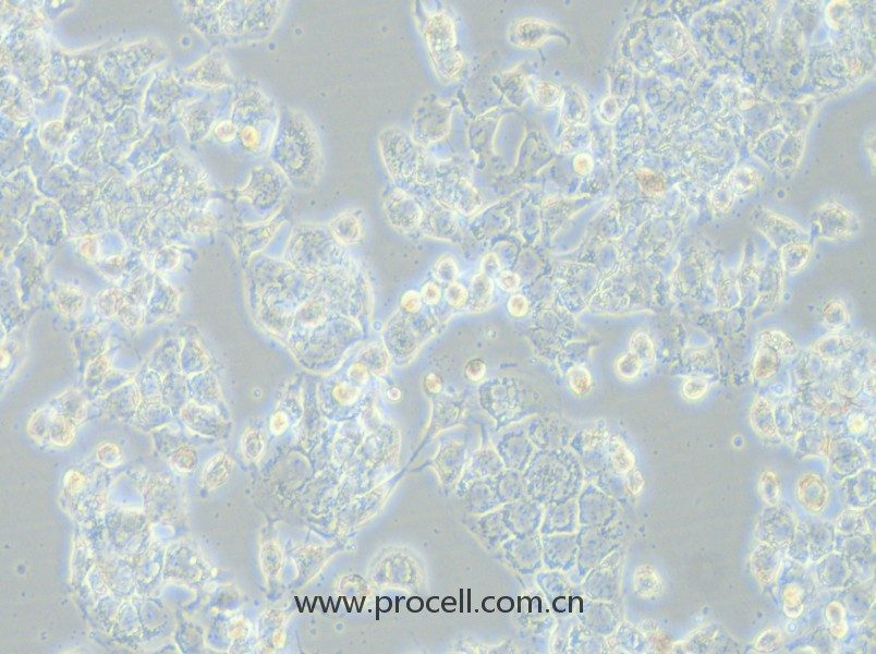 HCC1569（人乳腺癌細胞）（STR鑒定正確）