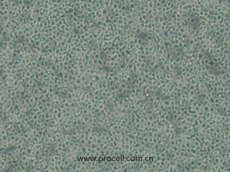 C1498-LUC (熒光素酶標(biāo)記的小鼠白血病細(xì)胞) (種屬鑒定正確)