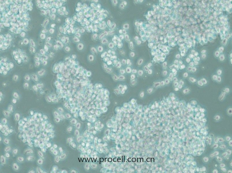 SUP-T1 (人T淋巴母細胞瘤細胞) (STR鑒定正確)