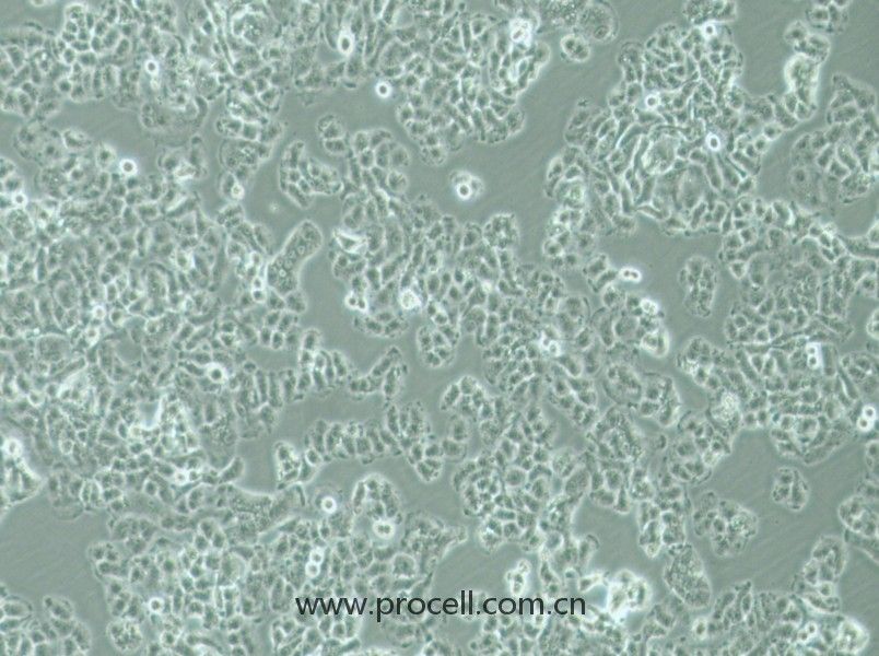 QGP-1 (人胰腺癌細(xì)胞) (STR鑒定正確)