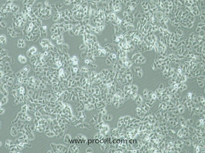 QGP-1 (人胰腺癌細(xì)胞) (STR鑒定正確)