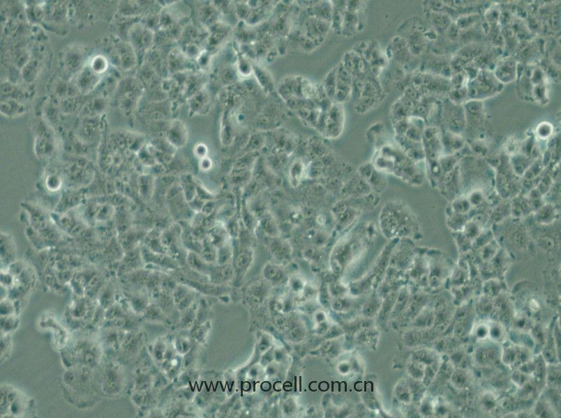 QGP-1 (人胰腺癌細(xì)胞) (STR鑒定正確)