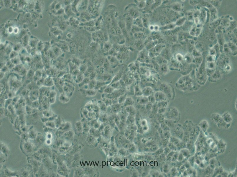 QGP-1 (人胰腺癌細(xì)胞) (STR鑒定正確)