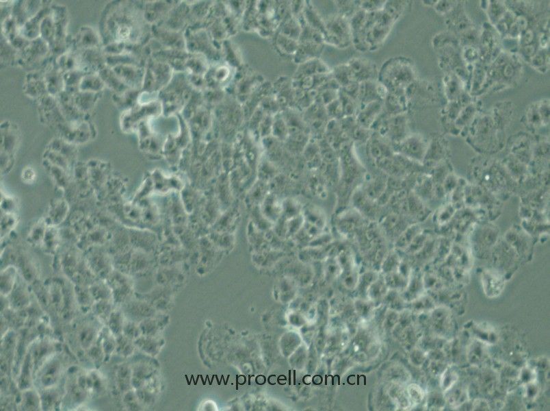 QGP-1 (人胰腺癌細(xì)胞) (STR鑒定正確)