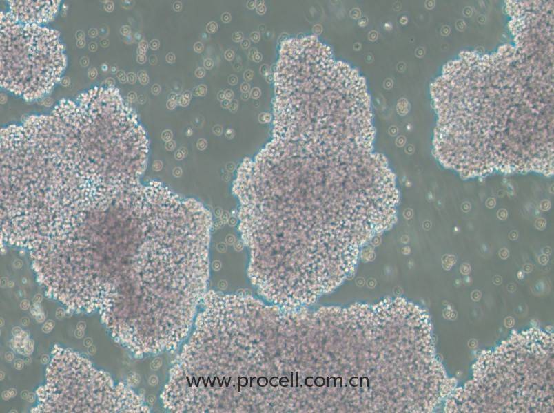 NCI-H1417（人小細胞肺癌細胞）（STR鑒定正確）