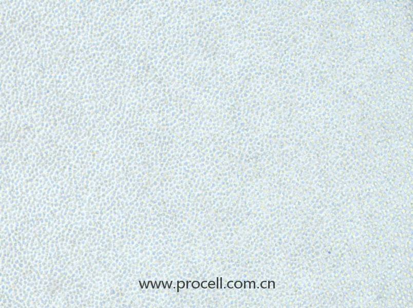 OCI-AML-2 (人急性髓性白血病細胞) (STR鑒定正確)