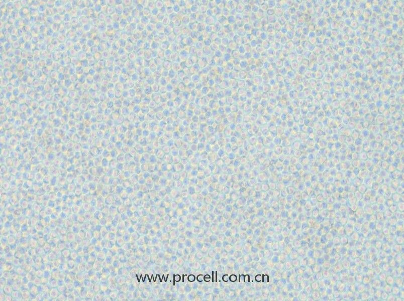 OCI-AML-2 (人急性髓性白血病細胞) (STR鑒定正確)
