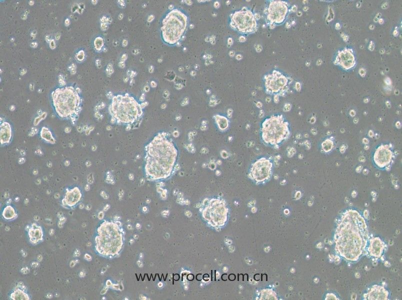 SK-ES-1（人骨肉瘤細胞）（STR鑒定正確）
