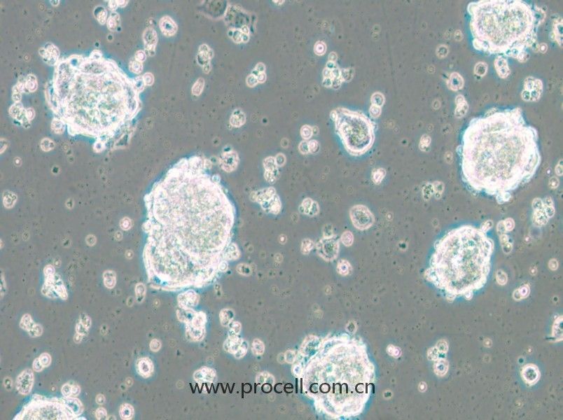 SK-ES-1（人骨肉瘤細胞）（STR鑒定正確）