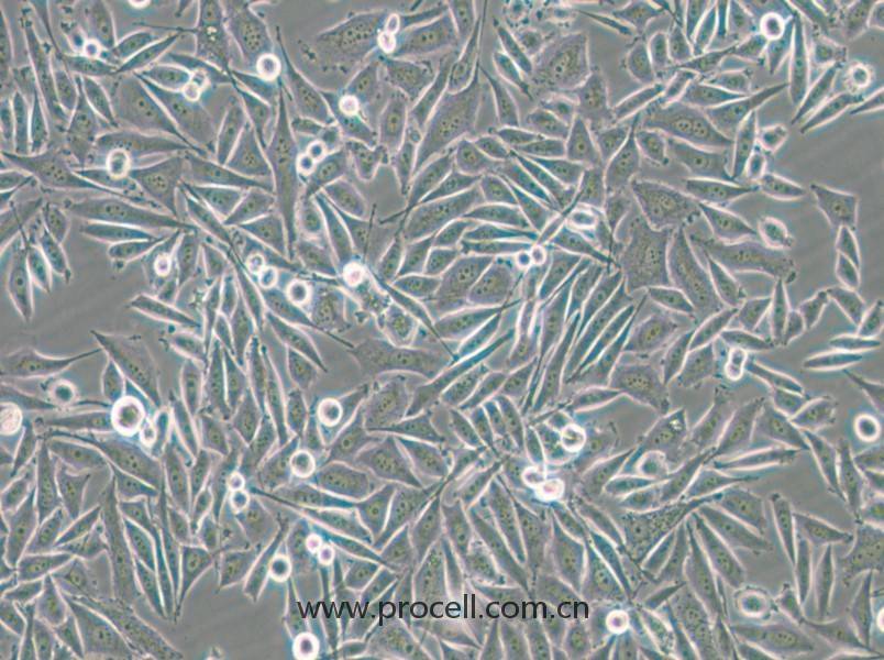 PC-3-GFP (人前列腺癌細(xì)胞（綠色熒光標(biāo)記）) (STR鑒定正確)