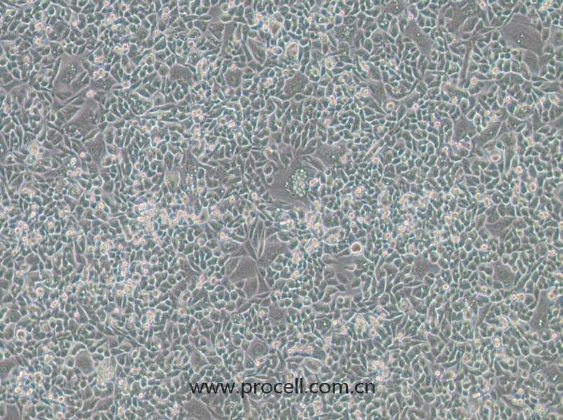 HCT-15-TAX (人結(jié)腸癌紫杉醇耐藥株) (STR鑒定正確)