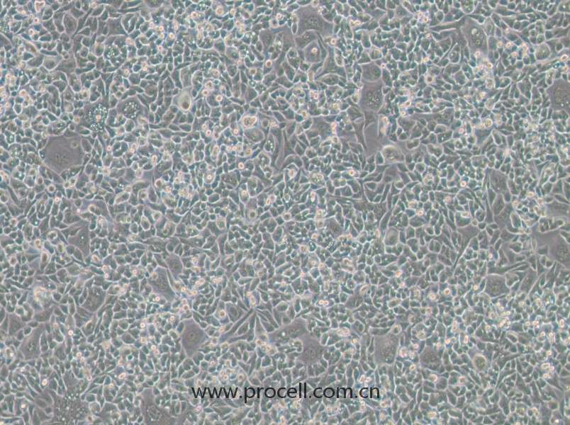 HCT-15-TAX (人結腸癌紫杉醇耐藥株) (STR鑒定正確)
