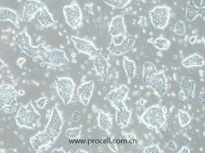 LC-2/ad（人肺腺癌細(xì)胞）（STR鑒定正確）