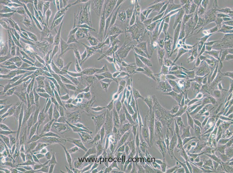 CCF-STTG1（人腦星形膠質(zhì)細胞瘤細胞）（STR鑒定正確）