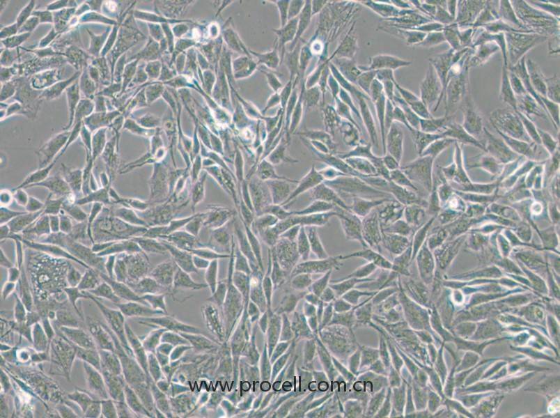 CCF-STTG1（人腦星形膠質(zhì)細胞瘤細胞）（STR鑒定正確）