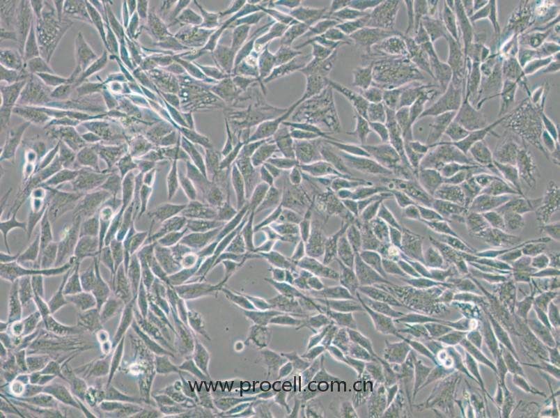 CCF-STTG1（人腦星形膠質(zhì)細胞瘤細胞）（STR鑒定正確）