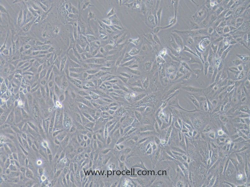 COV362（人卵巢癌細胞）（STR鑒定正確）
