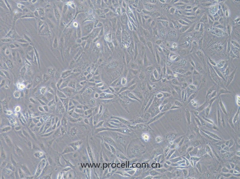COV362（人卵巢癌細胞）（STR鑒定正確）