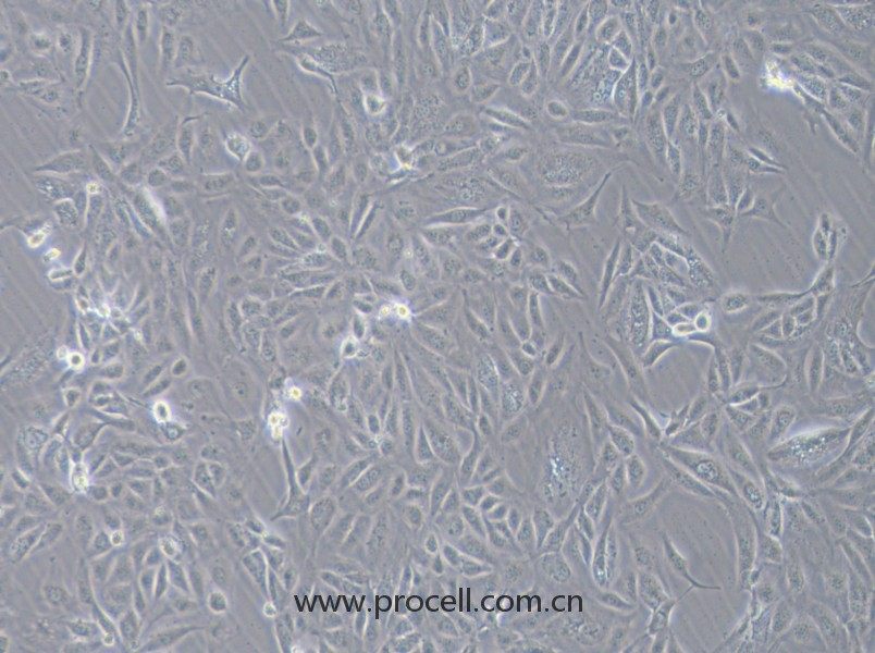 COV362（人卵巢癌細胞）（STR鑒定正確）