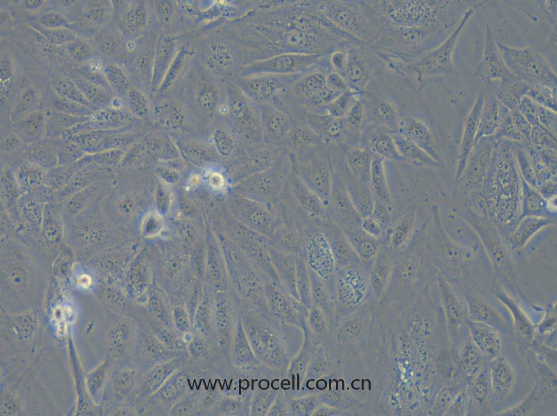 COV362（人卵巢癌細胞）（STR鑒定正確）