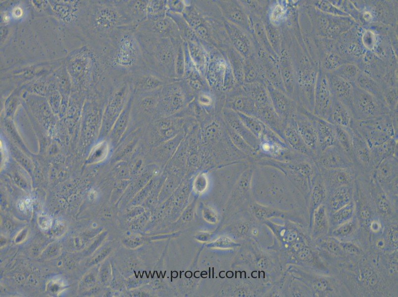 COV362（人卵巢癌細胞）（STR鑒定正確）