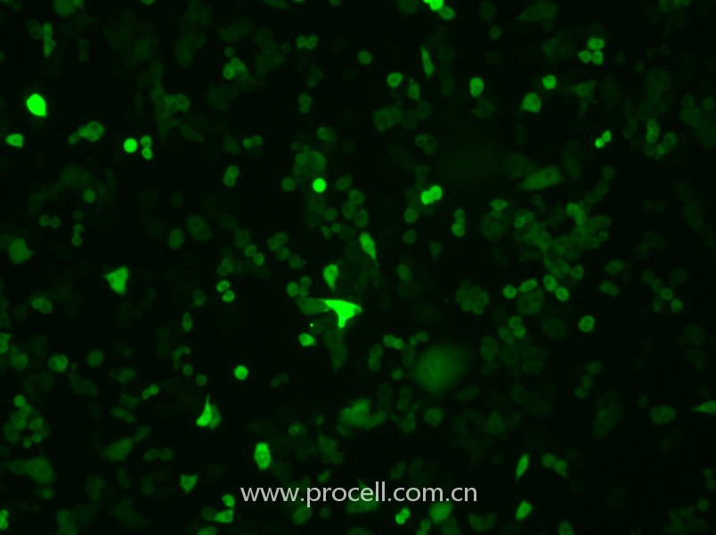 4T1-GFP（小鼠乳腺癌細(xì)胞（綠色熒光標(biāo)記））（STR鑒定正確）