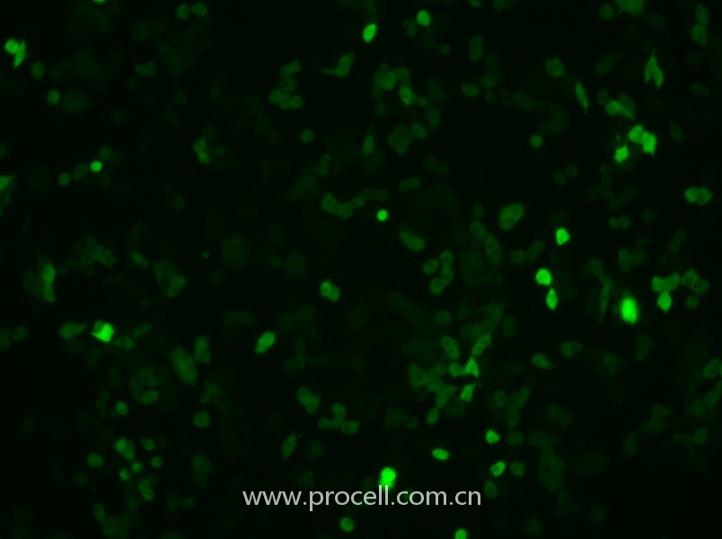 4T1-GFP（小鼠乳腺癌細(xì)胞（綠色熒光標(biāo)記））（STR鑒定正確）