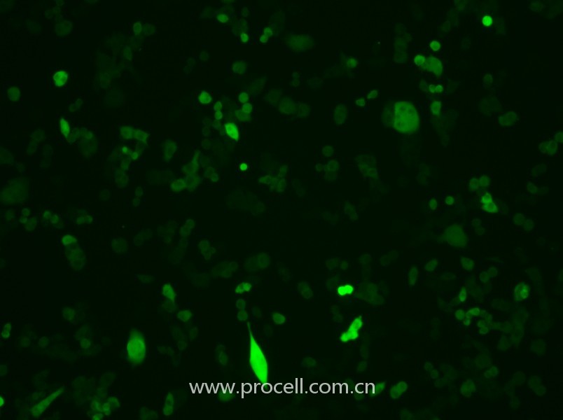 4T1-GFP（小鼠乳腺癌細(xì)胞（綠色熒光標(biāo)記））（STR鑒定正確）