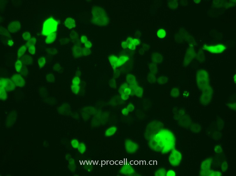 4T1-GFP（小鼠乳腺癌細(xì)胞（綠色熒光標(biāo)記））（STR鑒定正確）