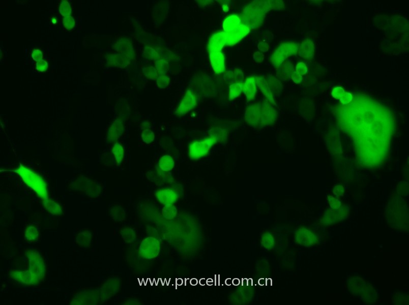4T1-GFP（小鼠乳腺癌細(xì)胞（綠色熒光標(biāo)記））（STR鑒定正確）
